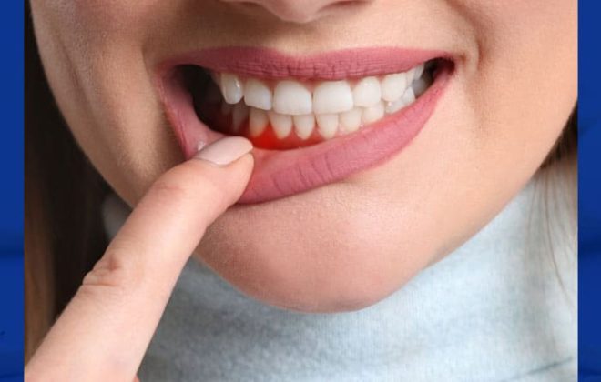 طرق علاج جيوب الاسنان