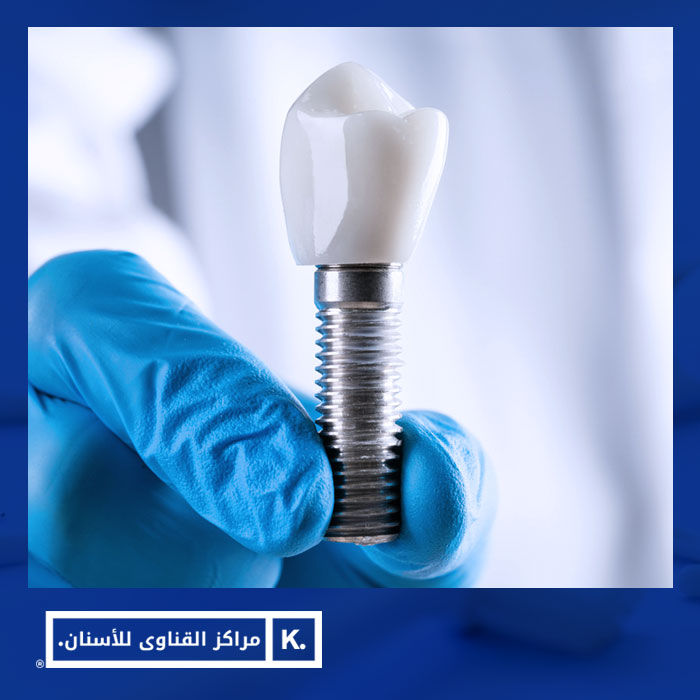 مراكز الأسنان فى مصر | 4 معايير تجعل تجربة علاج أسنانك ناجحة